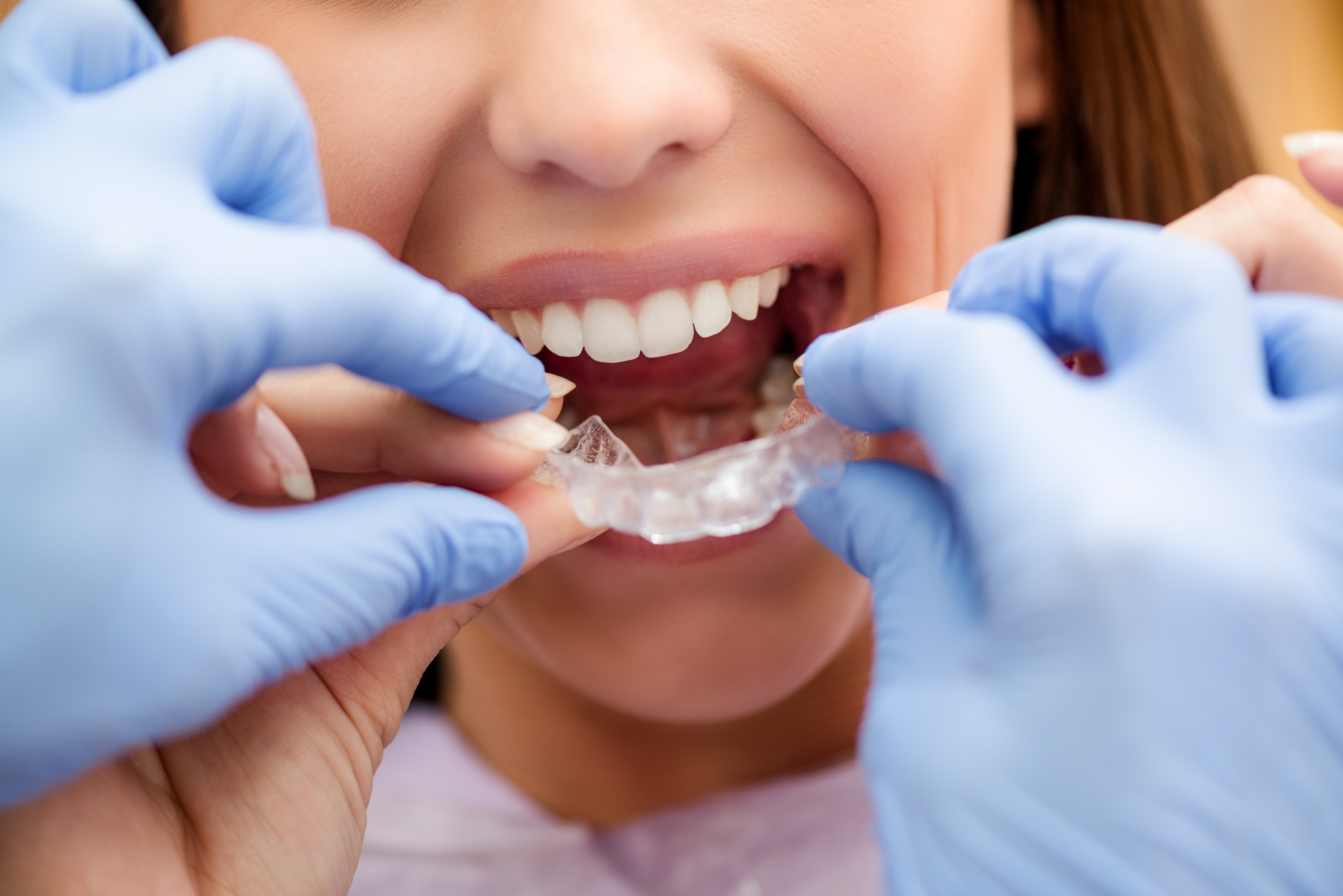 orthodontie-(1).jpg